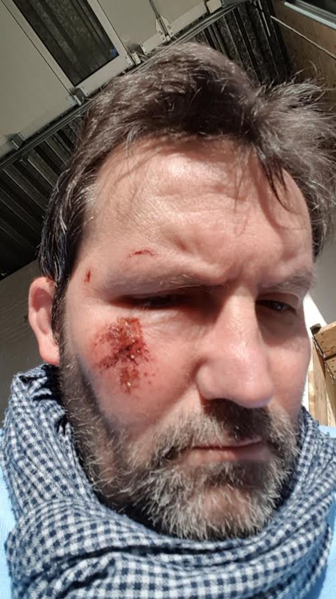 Rolstoeler Jos van Bragt maakte een selfie na zijn ongeval in Esch