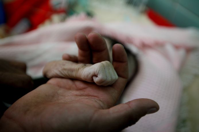 Een vader houdt het handje van zijn vier maanden oude dochtertje vast. Het meisje stierf door zware ondervoeding in Jemen.