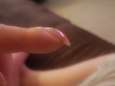 Foto van haar gebogen vingernagel op Facebook redt Britse vrouw het leven