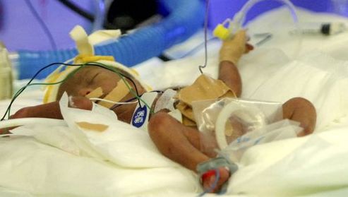 Duitse Baby Overleeft Geboorte Na 21 Weken Bizar Ad Nl