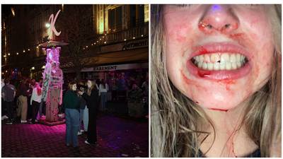Jongeman slaat bierglas stuk in gezicht van 16-jarig meisje op Oude Markt in Leuven: “Stel je eens voor dat dit op haar oog was?”