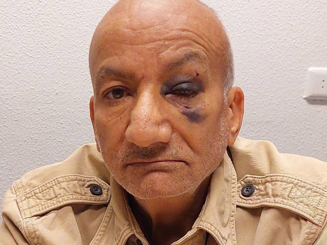 Man (71) ernstig mishandeld in tram: ‘Ze spraken me aan vanwege het kruis om mijn nek’