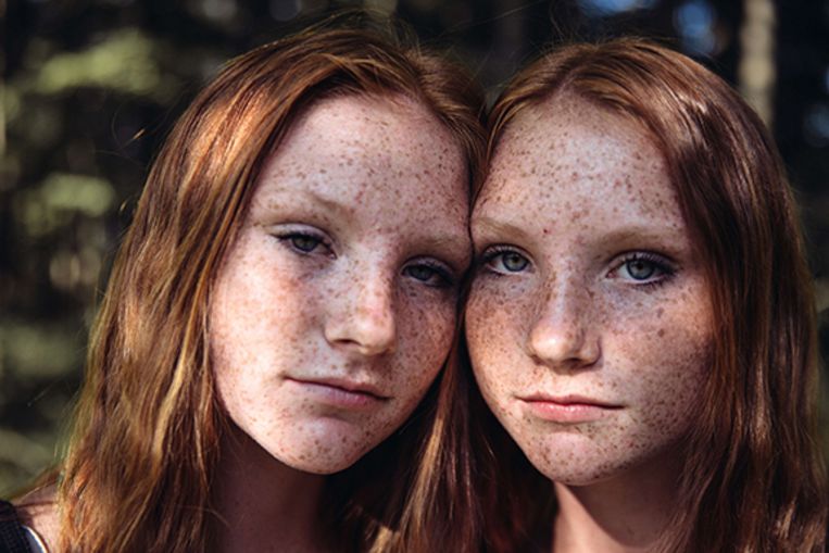 Come si formano i gemelli identici?  Questo mistero viene svelato a poco a poco dalla scienza