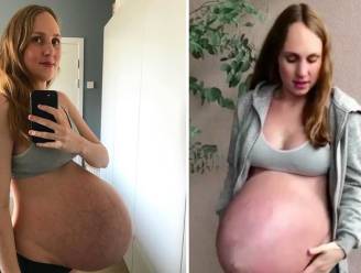 Maria is 34 weken zwanger van drieling en toont foto's van gigantische buik