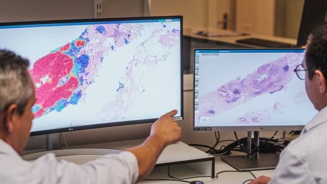 Het einde van de microscoop? Antwerps ziekenhuis gebruikt als eerste in Benelux artificiële intelligentie om kankercellen op te sporen: “Een extra paar virtuele ogen dat meekijkt”