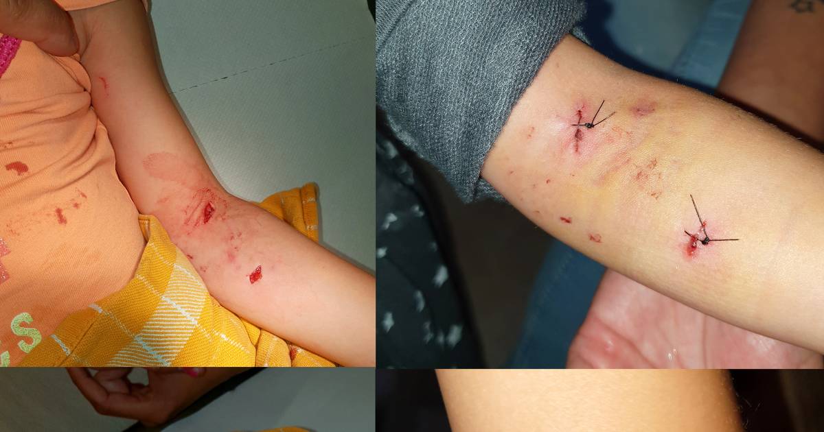 Hond die jongen beet had in juni al Roosendaals meisje (4) te pakken