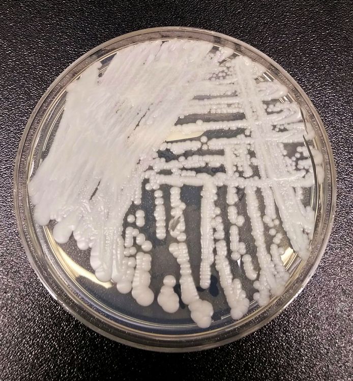 Een uitstrijkje in een petrischaaltje van candida auris in het Centers for Disease Control and Prevention (CDC).