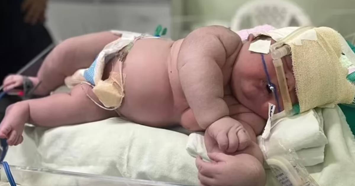 Какой колоссальный: бразильский малыш при рождении весил 7,3 килограмма |  Инстаграм ХЛН