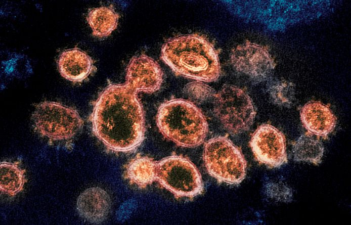 Des particules du virus SARS-CoV-2.