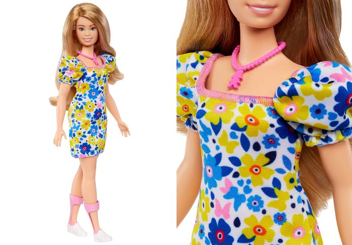 af hebben Vreemdeling Uitgaven Barbie lanceert bijzondere pop die veel 'vergeten' kindjes gelukkig zal  maken. “Zo'n belangrijk moment” | Instagram NINA | hln.be