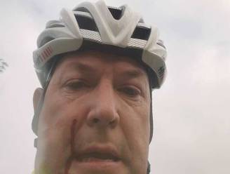 Bart (45) geraakt door hagel: “Heb niks tegen jagers, maar in de buurt van druk fietspad is dit onverantwoord”
