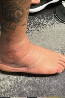 Dat ziet er niet goed uit voor Neymar: Brazili­aanse superster deelt foto van gezwollen voet 
