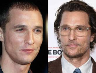 Nee, Matthew McConaughey heeft géén haartransplantatie gedaan