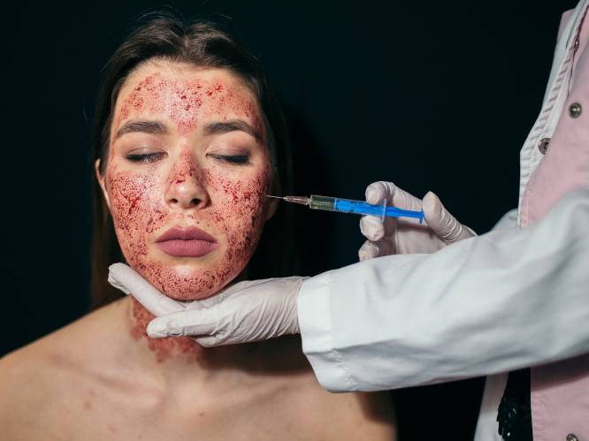 Drie vrouwen besmet met hiv na vampier-gezichtsbehandeling