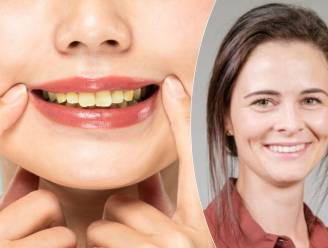 Wat eet je best niet uit voorzorg om gele tanden te vermijden? 3 tandspecialisten leggen uit: “Als je elk halfuur iets eet, beschadig je je tanden”