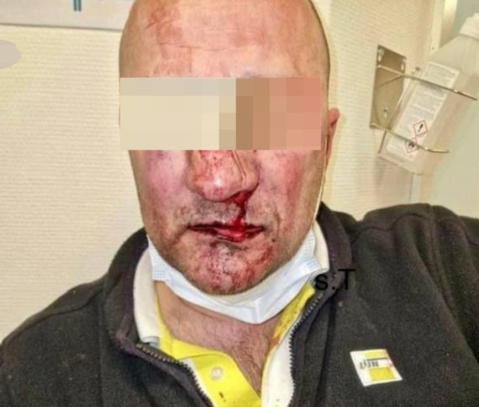 Agressie tegenover werknemer De Lijn in Limburg.