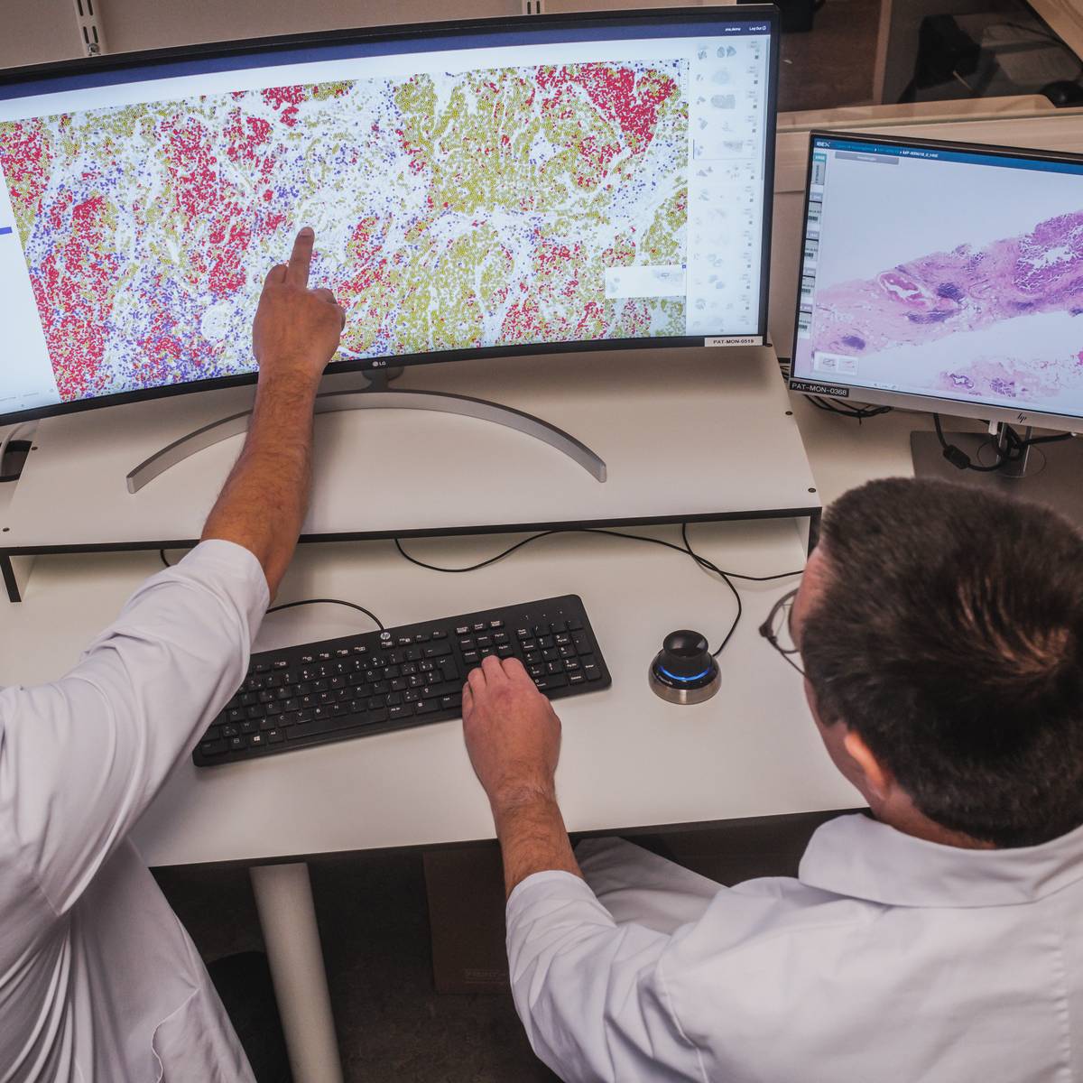 ZAS kan tumor 17% sneller analyseren door artificiële intelligentie: “Eén  werkdag tijdswinst per onderzochte prostaattumor” | Antwerpen | pzc.nl