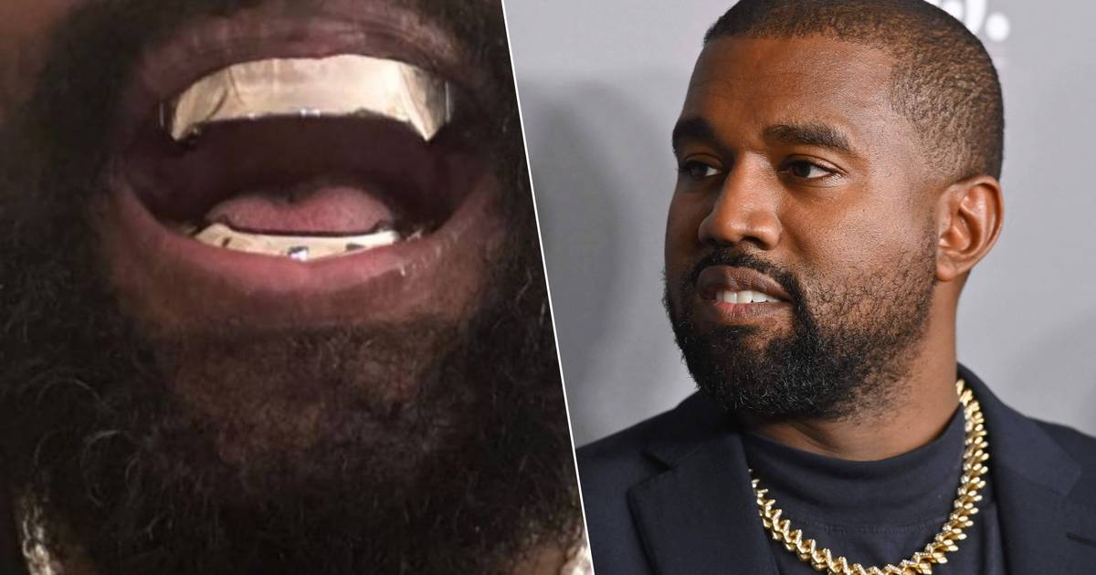Kanye West removed his teeth and replaced them with titanium ones: “This costs about 780 thousand euros” |  celebrities