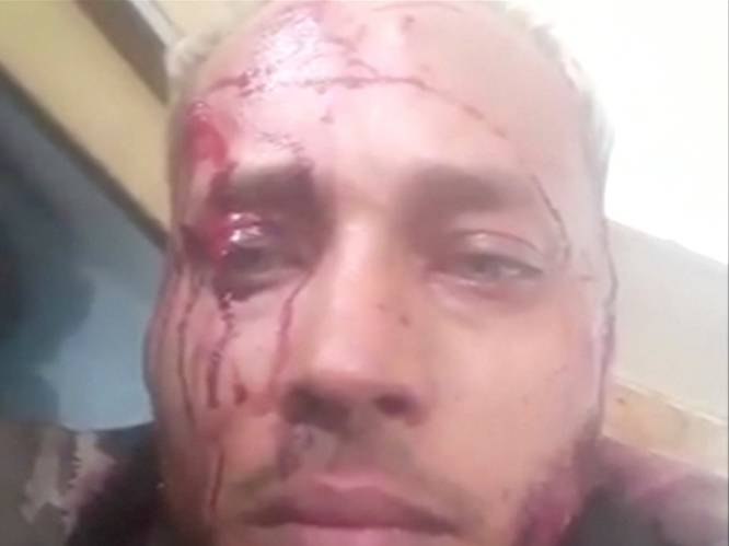 Venezolaanse leger richt bloedbad aan onder opstandelingen: rebellenleider deelt aanval via sociale media