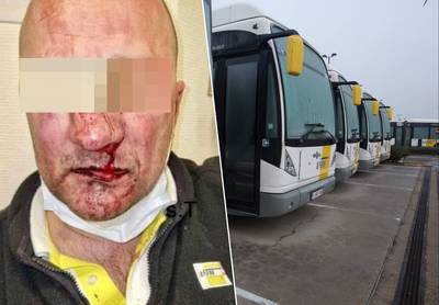 “Hij werd uit de bus gesleurd en voor dood achtergelaten”: na zware agressie tegen De Lijn-chauffeur eisen vakbonden maatregelen