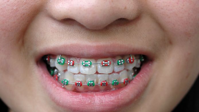 Comment faire des fausse bague dentaire clearance