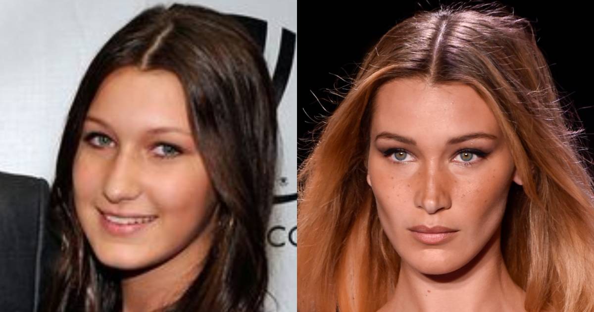 Bella Hadid si è sottoposta a rinoplastica all’età di 14 anni perché si sentiva la ‘brutta sorella di Gigi’: ‘Non lasciare che il resto mi scappi in faccia’ |  celebrità