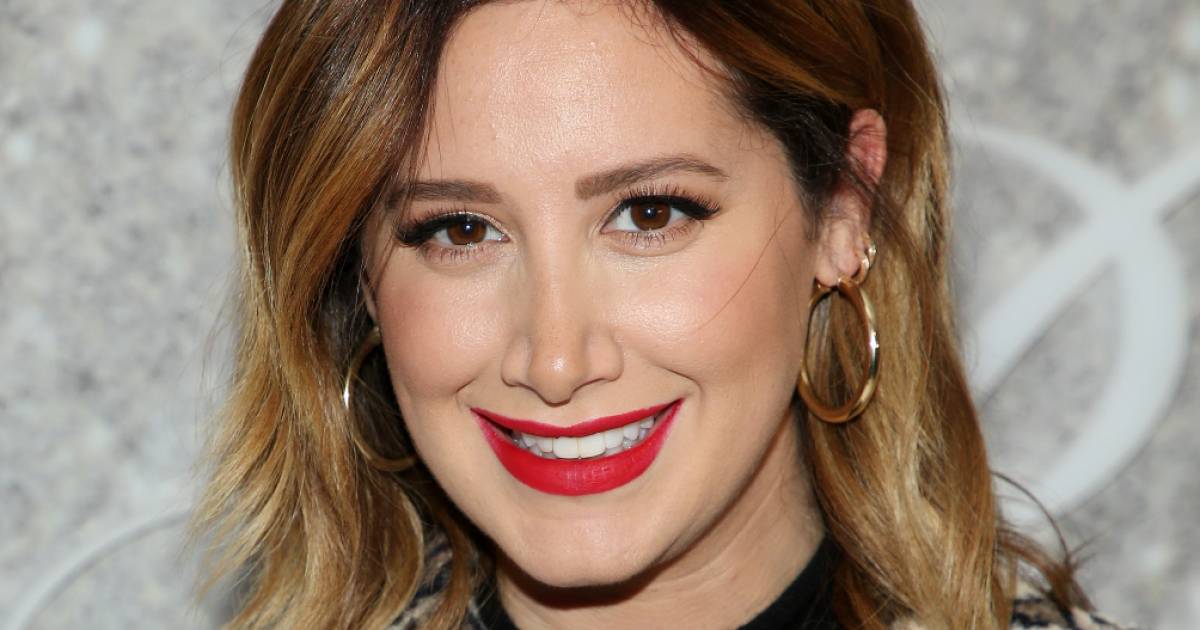 Ashley Tisdale suffers from autoimmune alopecia: ‘Nothing to be ashamed of’ |  showbiz