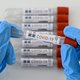 Coronavirus was zeker al op 27 december in Frankrijk