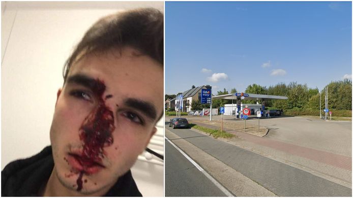 De jongeman liep onder meer een gebroken neus op door het incident aan het tankstation.