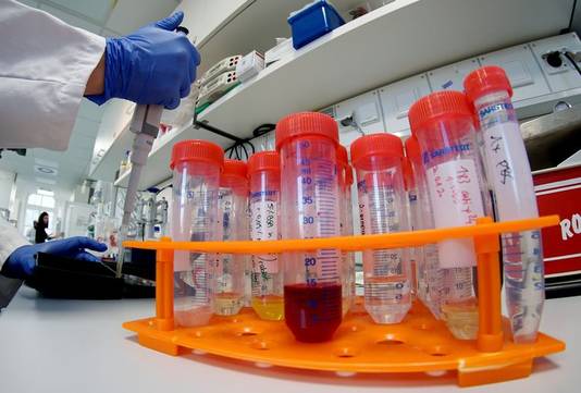Stalen van mogelijk besmette patiënten in een Duits labo. In ons land worden die naar het UZ Leuven gebracht.