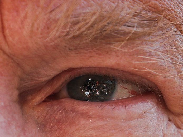 De bewuste foto van het oog van Trump.