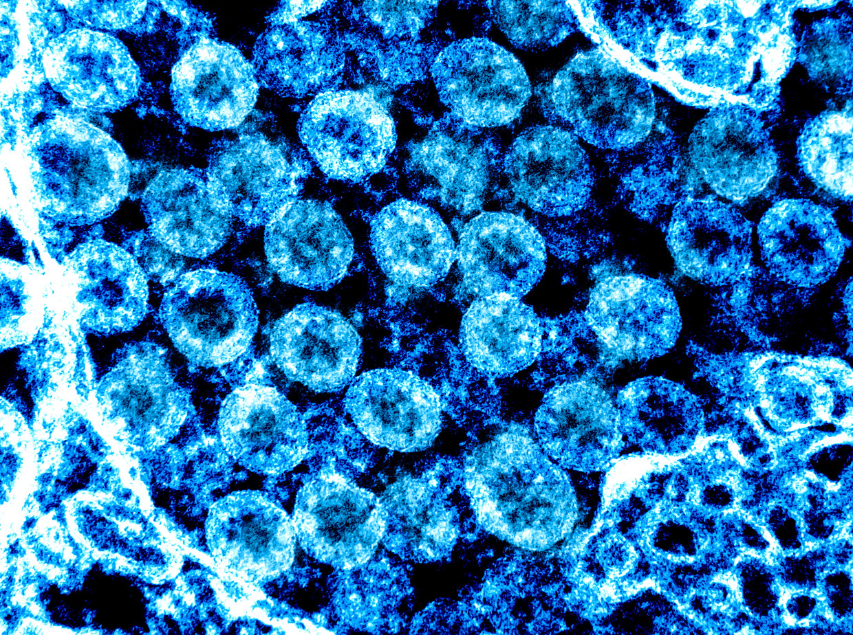 Het coronavirus onder de microscoop. Beeld EPA