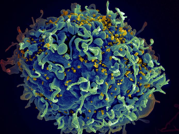 Beeld van een elektronische microscoop van een menselijke T-cel (blauw), geïnfecteerd door hiv (geel).