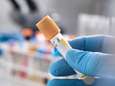 Opnieuw minder hiv-diagnoses in 2018, maar ziekte treft diverser publiek