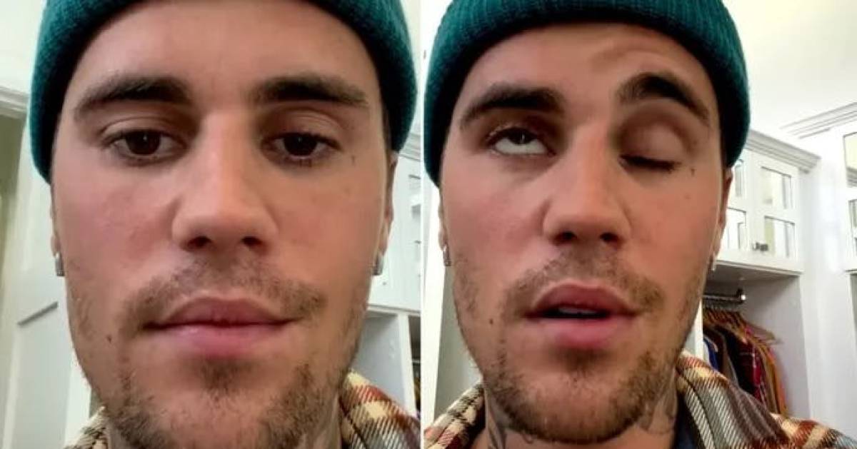 Justin Bieber si sta riprendendo dalla paralisi facciale: ‘Era una situazione spaventosa’ |  Gente famosa