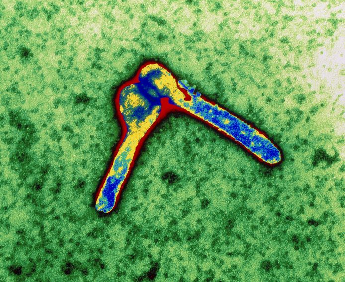 Microscopische afbeelding van het marburgvirus.