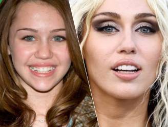 “Ze heeft haar tandvlees omhoog laten trekken”: tandarts onthult geheim achter Hollywoodglimlach van Miley Cyrus