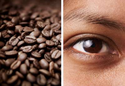 Last van donkere kringen of gezwollen ogen? Dermatoloog legt uit hoe het komt en hoe je het verhelpt