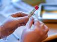 416 cas en une journée, la moyenne des infections augmente de 89%