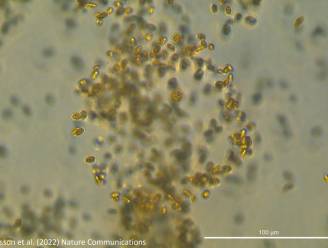 Microbe ontdekt die ingezet kan worden als 'geheim wapen' tegen klimaatopwarming