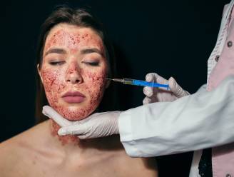 Drie vrouwen besmet met hiv na vampier-gezichtsbehandeling