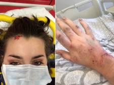 Floriane renversée par une auto dans la région de Charleroi: “J’ai été projetée sur 16 mètres”