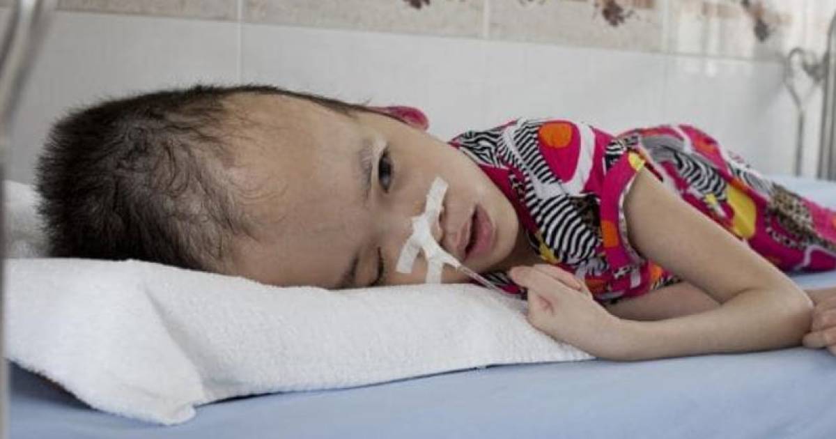 Agent Orange Ruim Veertig Jaar Na De Oorlog Is Miljoen Vietnamezen Misvormd Of Ziek Door Amerikaans Ontbladeringsmiddel Buitenland Hln Be