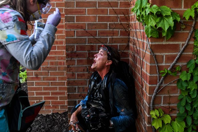 Een lid van de pers wordt verzorgd na een aanval met traangas en rubberkogels door de politie in Minneapolis.