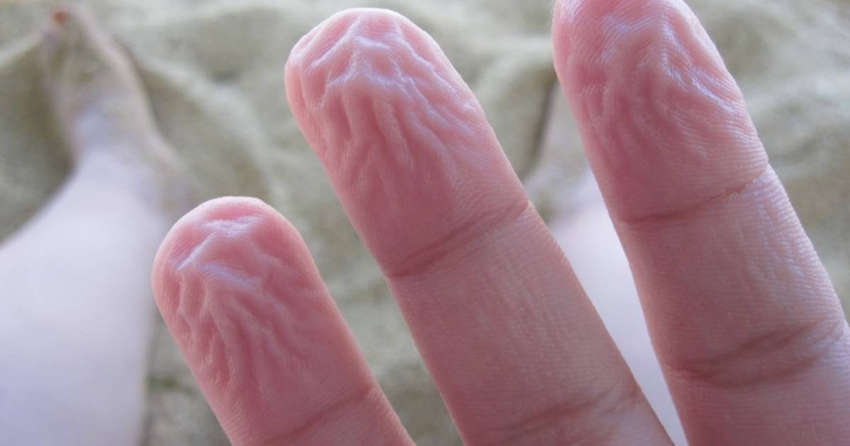 Waarom Rimpelen Vingertoppen Na Een Bad Gezond Bd Nl