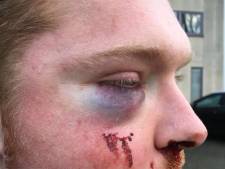 Dader(s) zware mishandeling Eindhoven spoorloos: 'Het is een puzzel'