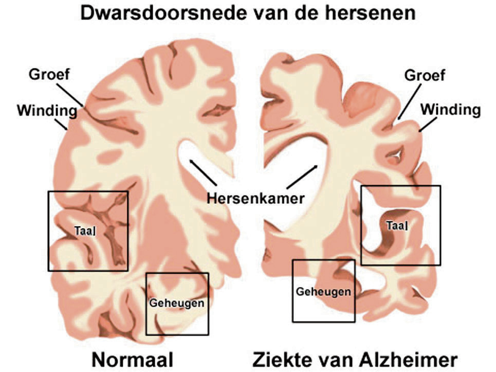 Geheugenprofessor Douwe Vergeetachtig worden is niet