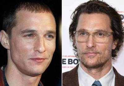 Nee, Matthew McConaughey heeft géén haartransplantatie gedaan