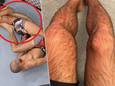 Links: de knie van Mokaev plooit op een onnatuurlijke wijze. Rechts: de schade.