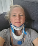 Door Marina's ziekte is haar bindweefsel zo zwak, dat haar nek haar hoofd niet meer kan dragen.